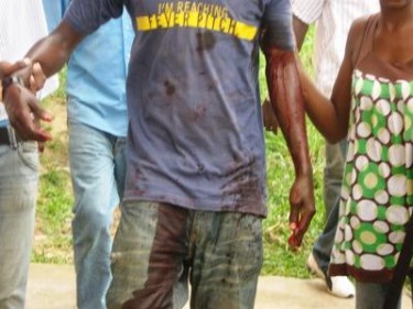 Student wounded at protests at the University Omar Bongo, Gabon. Image by Camarade on Le Post.