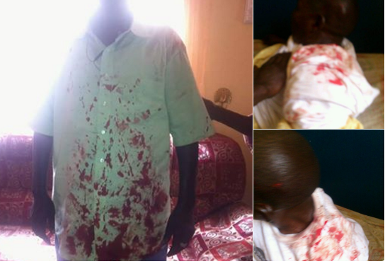 A screenshot of a Twitter image of injured activists posted by Gambian journalist @freejobe39.