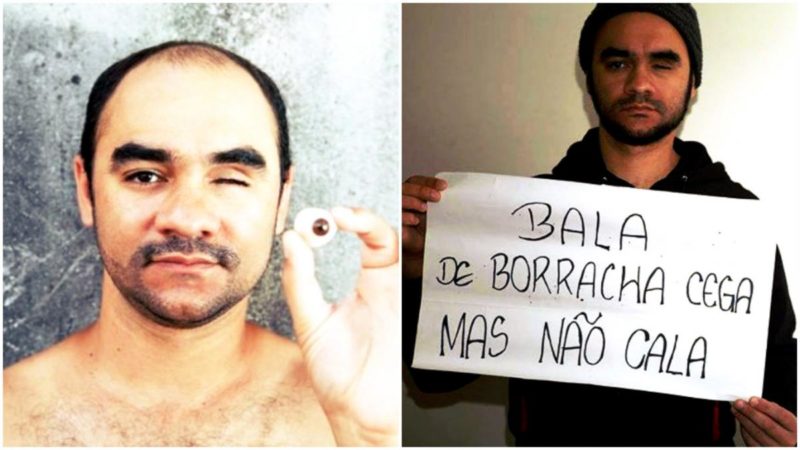 Sérgio Silva with a glass eye and with a sign "Rubber bullet blinds, but won't silence"