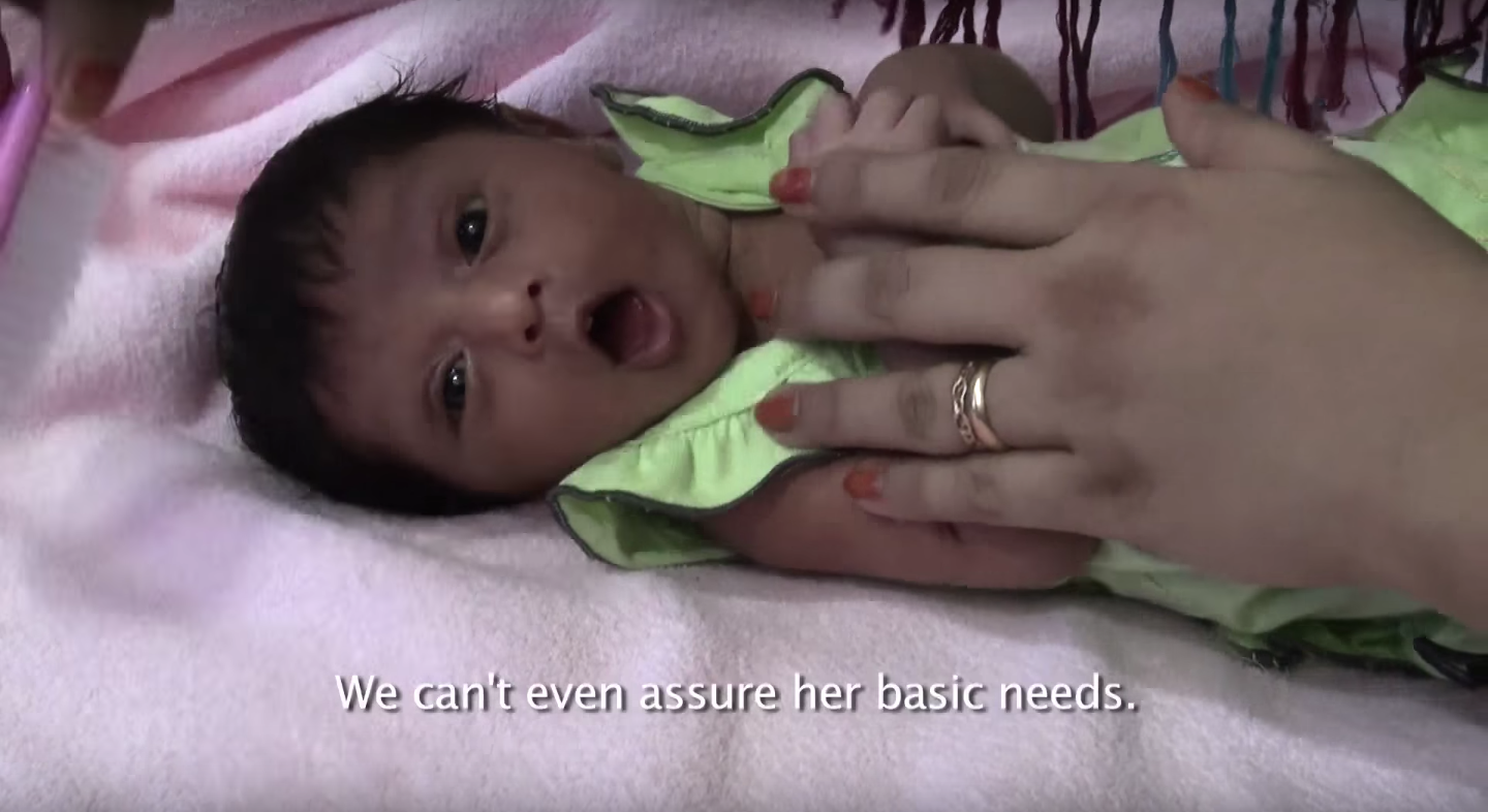 Captura de tela do documentário de MSF USA 'War in Aden: Surviving the Everyday' mostrando uma criança desnutrida no Iêmen. Fonte: Youtube.